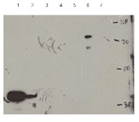 HDT1 | Histone deacetylase in the group Antibodies Plant/Algal / DNA/RNA/Cell Cycle / Nuclear signaling at Agrisera AB (Antibodies for research) (AS11 1792)